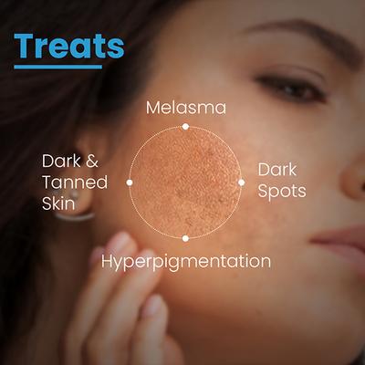 FCL AHA Lightening Gel GHQ Glycolic Acid Treats Hyperpigmentation, Reduce Dark Spots 15 ml - Scrubs & Exfoliants