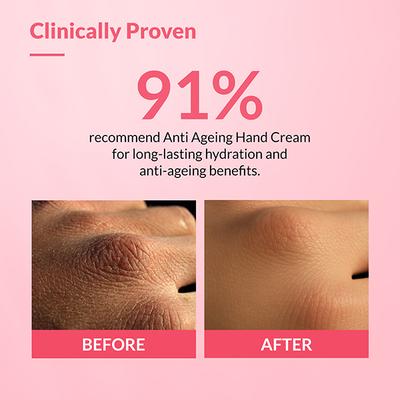 Fixderma Anti Ageing Hand Cream for Women and Men for Dry and Rough Hands All Skins Types 30 gm - Night Cream