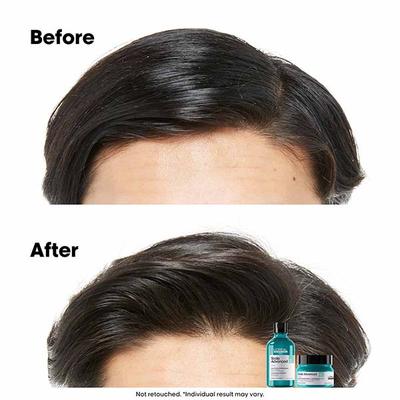 L'Oreal Professionnel Scalp Advanced Anti-Oiliness Dermo-Purifier Shampoo 300 ml - Shampoos