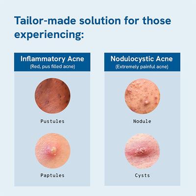 Be Bodywise 2.5% Benzoyl Peroxide Face Wash 100 ml - Face Wash & Cleansers