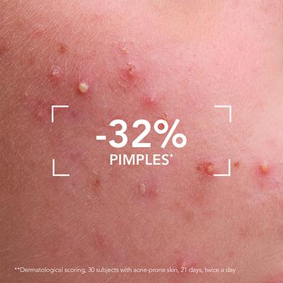 Bioderma Sebium Gel Moussant Actif Intense Purifying Cleansing Foaming Gel 45 ml - Face Gels