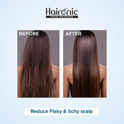 Haironic Salicylic Acid Oil & Flake Control Hair Serum 100 ml - Hair Treatment