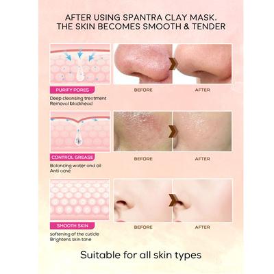 Spantra Oil Control Clay Mask With Lemon & Rosemary Oil 125 gm - Masks & Peels