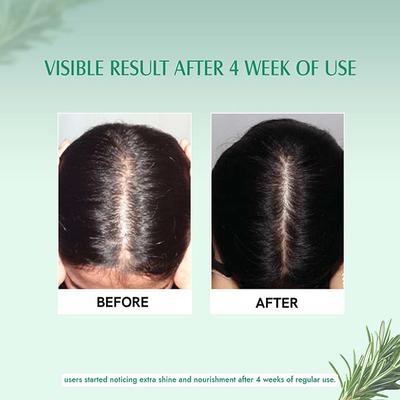 Aravi Organic 100% Pure Natural Rosemary Essential Oil For Hair Growth and Nourish Skin 50 ml - Essential Oils