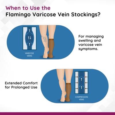 Flamingo Varicose Vein Stockings (OC - 2012) (XL) 1's - Knee/Ankle/Leg/Foot Supports
