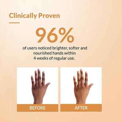 Fixderma Brightening Hand Cream for Women and Men, for Dry and Rough Hands All Skins Types 30 gm - Night Cream