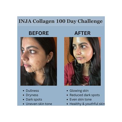 Inja Wellness Beauty Collagen For Skin, Hair & Nails, with Vit C, Glutathione,Biotin & More -Lychee Flavour 125 gm - Hair & Skin