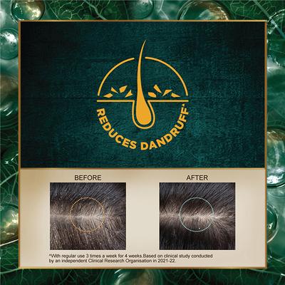 Indulekha Dandruff Treatment Shampoo 200 ml - Shampoos