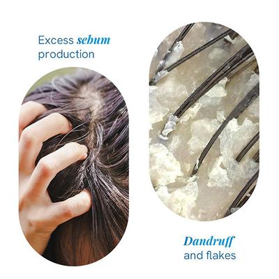 Be Bodywise Anti Dandruff Shampoo-Removes Visible Flakes 150 ml - Shampoos