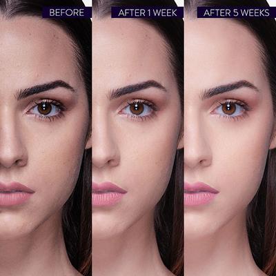 Belora Paris Serum Superb Skin (Serum Superbe Peau) 20 ml - Face Gels