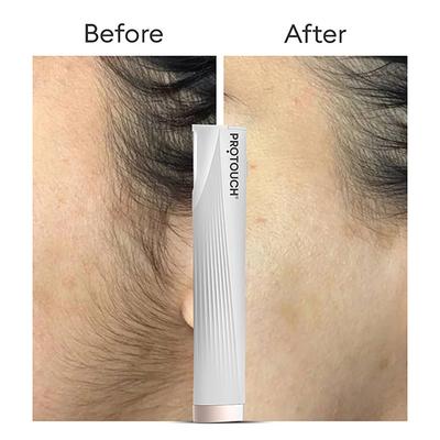 Protouch Dermaplaning Device Electric , 2 in 1 Eyebrow & Face Hair Remover with Gentle Exfoliation 1's - Others