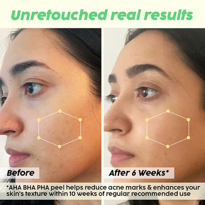 Plix The Plant Fix 25% Aha + 2% Bha + 5% Pha Peeling Solution For Glowing 30 ml - Face Gels