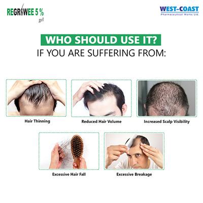 REGROWEE 5% Gel 50gm - Hair Loss-Oth