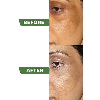 Organic Harvest Activ Skin Lightening Cream 50 gm - Face Creams