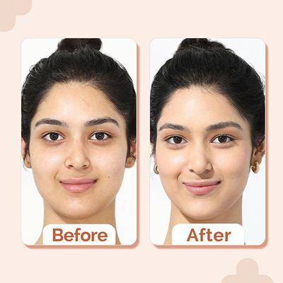 The Derma Co. 2% Niacinamide High Coverage Foundation, 1% Hyaluronic Acid and SPF 40 PA+++ for 12 Hr - 02 Nude 30 gm - Foundation
