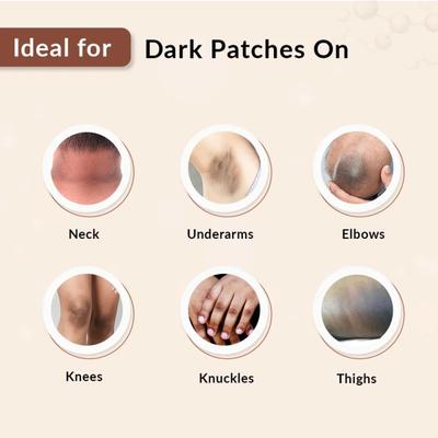 Fixderma Nigrilite Cream 100 gm - Creams/Oils/Lotions