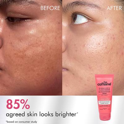 Mcaffeine 2% Kojic Acid and 1% Niacinamide De-Pigmentation Cream All Skin Tone 50 gm - Face Moisturizers