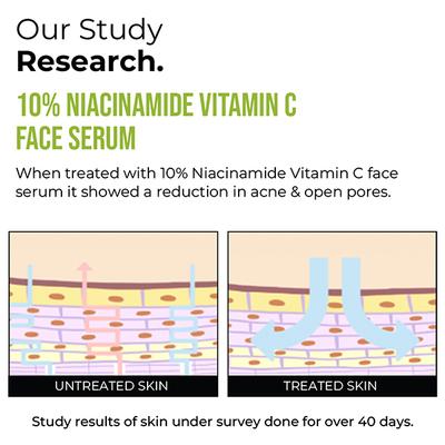 Insight Cosmetics 10% Niacinamide Vitamin C Face Serum 30 ml - Face Serum