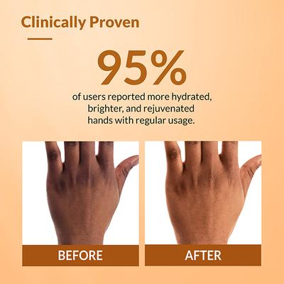 Fixderma Hand Cream for Women and Men, Hand Cream for Dry and Rough Hands All Skins Types 30 gm - Night Cream