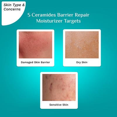 Pilgrim 5 Ceramides Barrier Repair Moisturizer with Korean CICA Lightweight & Non-Sticky 100 g - Face Moisturizers