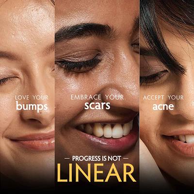 LISEN Pure Genius Multi - Action Peel Stick, Pack of 10 with AHA and BHA for Blackheads, Whiteheads 10's - Masks & Peels