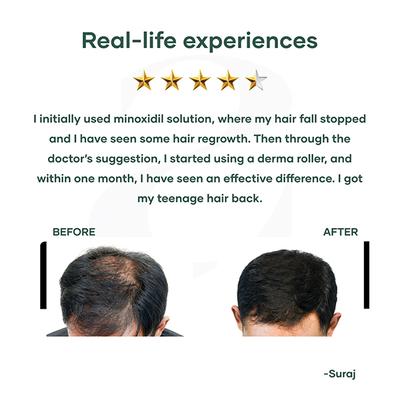 Mars By GHC Derma Roller With 540 Titanium Alloy Micro Needles 340 gm - Derma Rollers