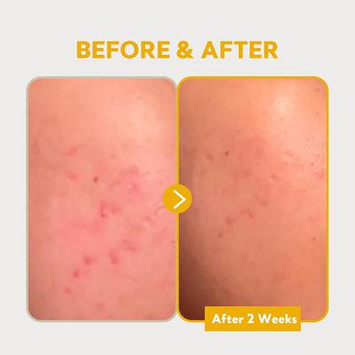 Tirtir Pure Vitamin C24 Serum Advanced 30 ml - Face Serum