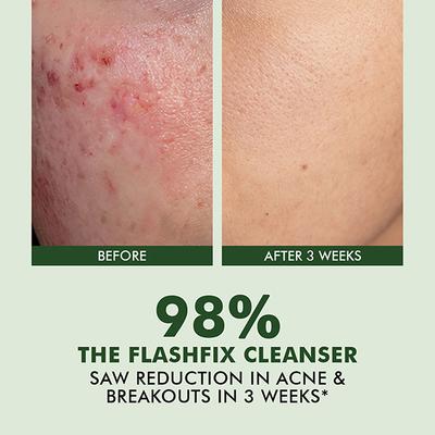 Conscious Chemist Daily Face Wash For Oily Acne Prone Skin With Aha, Bha & Cica Extract 100 ml - Face Wash & Cleansers