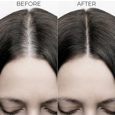 Brillare Hair Fall Control Shampoo Hair Fall 300ml - Shampoos