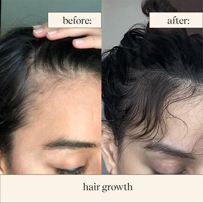 inde wild 1% Bakuchiol serum with Squalane to restore skin barrier and firmness and even out skin tone 10 ml - Face Serum