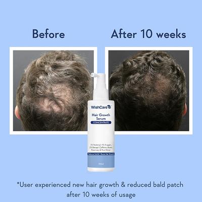 WishCare Hair Growth Serum Concentrate 100 ml - Hair Combs