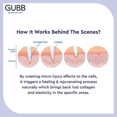 Gubb Derma Roller 540 Needles 0.5mm - Golden 1's - Derma Rollers