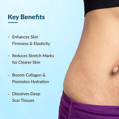 Fixderma Strallium Stretch Mark Cream 75 gm - Stretch Mark Cream