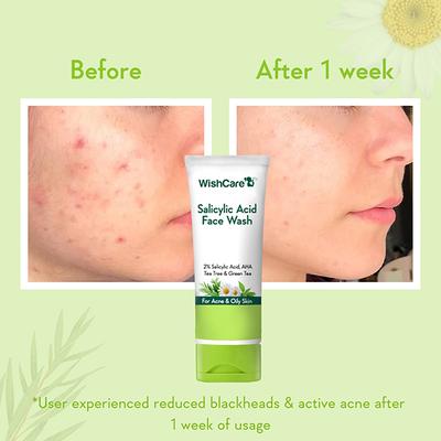 WishCare 2% Salicylic Acid Face Wash with AHA GreenTea Chamomile & TeaTree - For Oil & Acne Control 100 ml - Face Washes