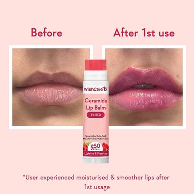 WishCare Tinted Ceramide Lip Balm with SPF50 PA+++ - Kojic Acid & Niacinamide - For Lip Lightening 5 gm - Lip Balms