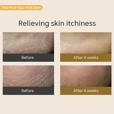 Thank You Farmer Rice Pure Aqua Multi Balm 10 gm - Face Moisturizers