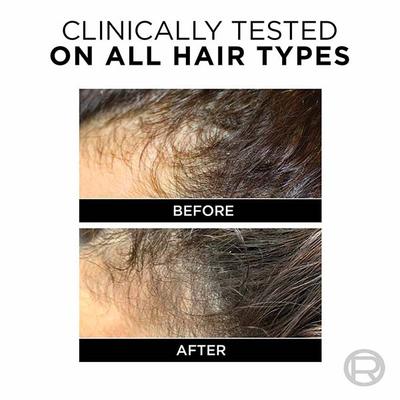 L'Oreal Paris Fall Resist 3X Anti-Hair Fall Shampoo Fragile Hair Tendency To Fall 180ml - Shampoos