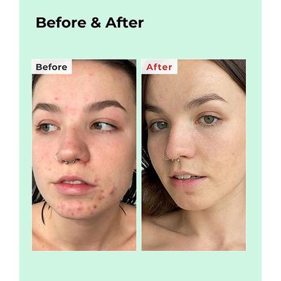 COSRX BHA Blackhead Power Liquid 100 ml - Toners