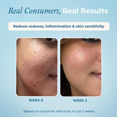 The Pink Foundry Gentle Hydrating Creamy Face Wash 125 ml - Face Wash & Cleansers