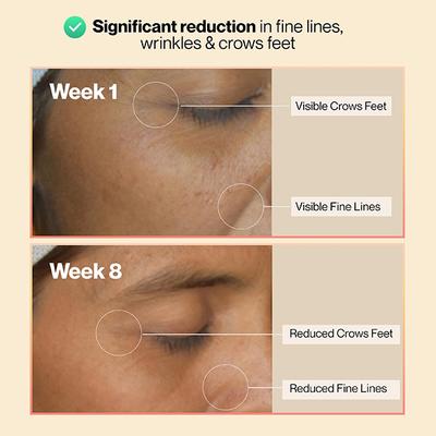 Setu Skin Youthful Marine Collagen Powder Supplements for men and women 210 g Peach Mango Flavour 1's - Multi-Vitamins