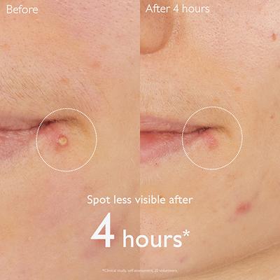 Caudalie Vinopure Salicylic Spot Solution 15 ml - Face Moisturizers