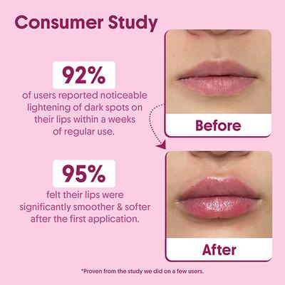 Aravi Organic Beetroot Lip Lightening Scrub Balm For Dark, Chapped and Pigmented Lips 15 gm - Lip Scrubs