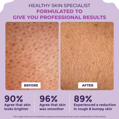 Sanfe Clear and Confident Glycolic Acid Body Lotion Daily AHA Lotion, Smooths Rough and Bumpy Skin 200 ml - Creams, Lotions & Oils