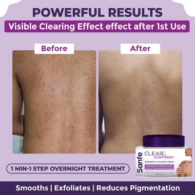 Sanfe Clear and Confident Overnight Glow Body Cream Exfoliates Reduces Dark Patches Pigmentation 100 gm - Creams, Lotions & Oils
