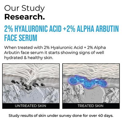 Insight Cosmetics 2% Hyaluronic Acid + 2% Alpha Arbutin Face Serum 30 ml - Face Serum