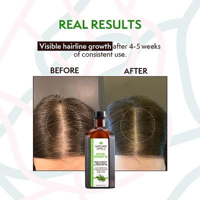 Nature Spell Rosemary With Jamaican Black Castor Oil For Hair & Skin 150 ml - Hair Oils