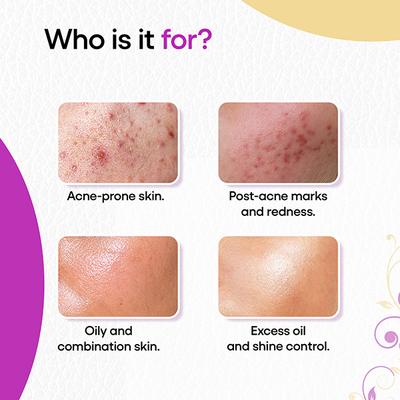 Akmasq Face Mask Cream 75gm - Dry Skin-Emo