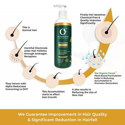 Organic Forest Anti Dandruff Shampoo 200 ml - Shampoos