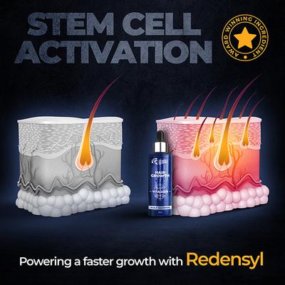 Beardo Scalp Regenesis Hair Growth Vitalizer 60ml - Hair Treatment