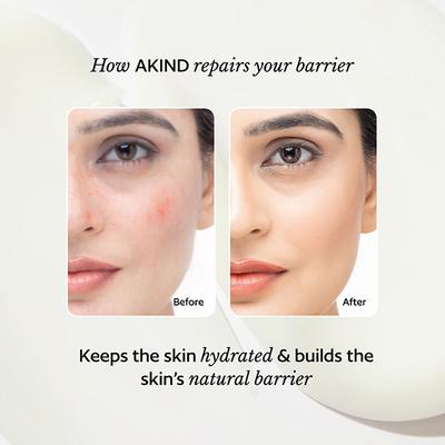 Akind On Cloud Nine Lightweight Moisturizer 50 gm - Face Moisturizers